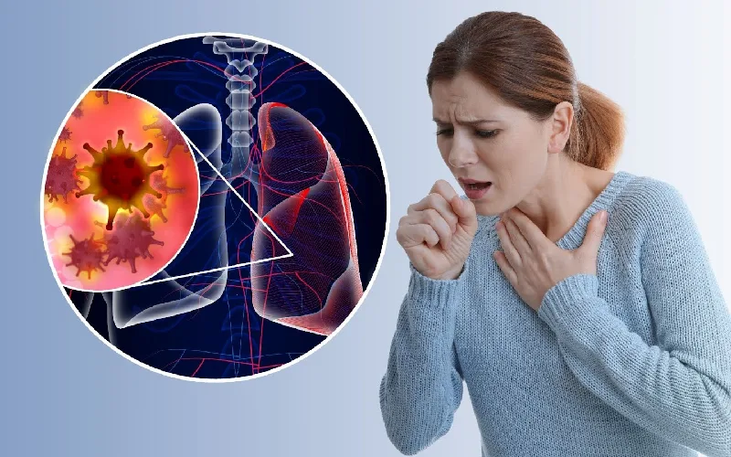Ho kéo dài sau khi cúm - Nguyên nhân và cách giảm ho hiệu quả