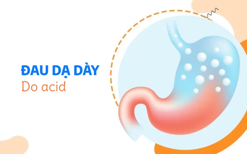 Sự khác biệt giữa đau dạ dày do acid – vi khuẩn – thần kinh ruột
